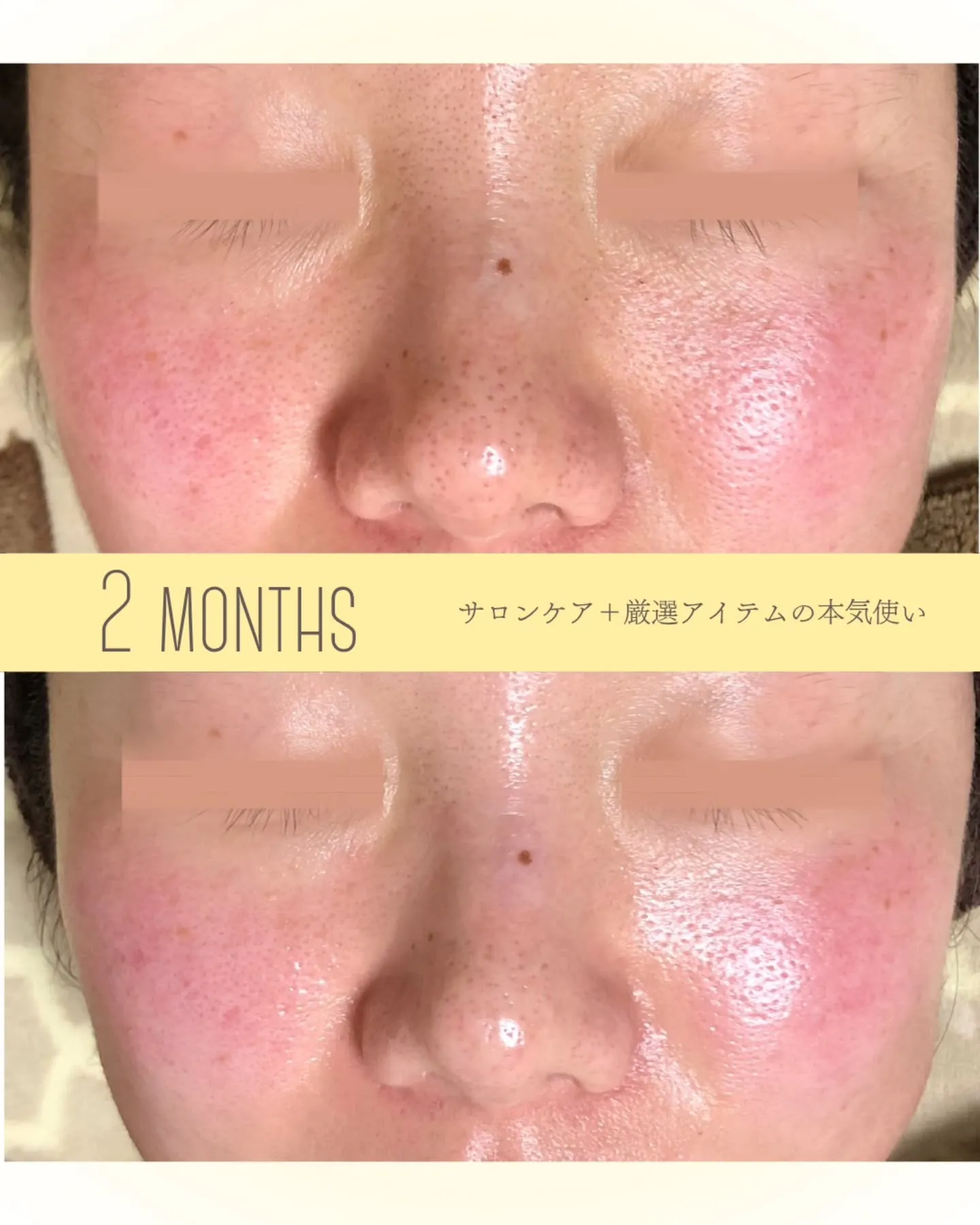 【1つのアイテムが1つの結果とは限らない】