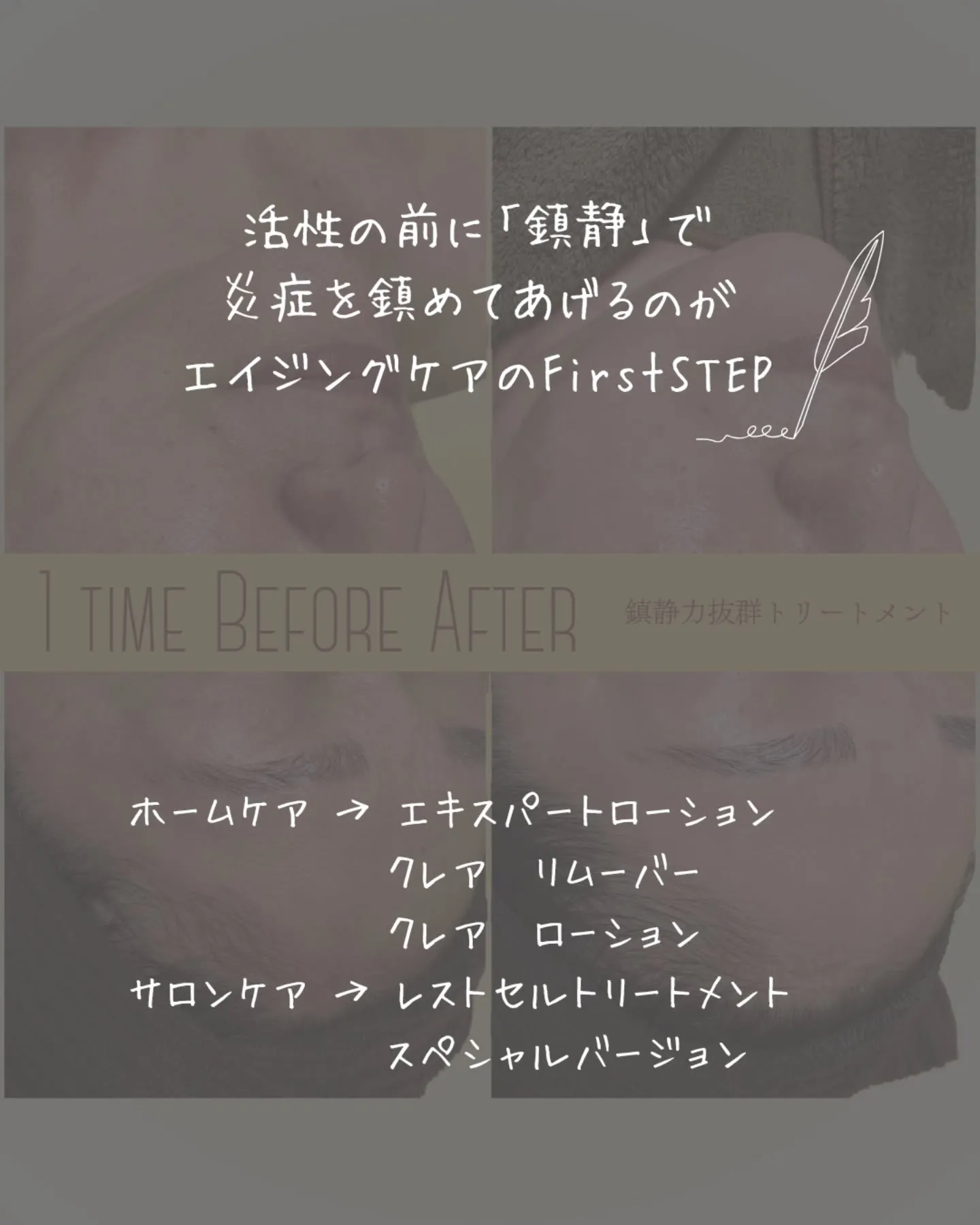 【美肌の道は鎮静の1歩から】