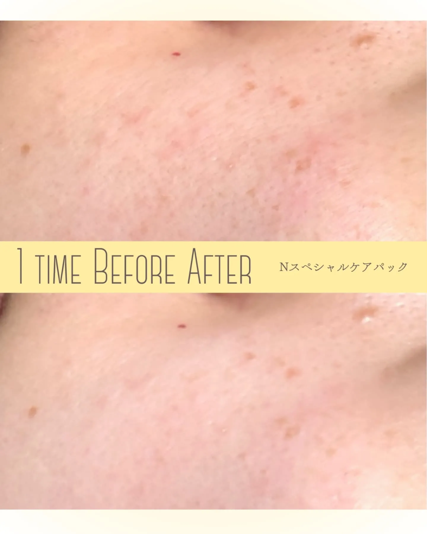 【振るだけじゃない！より鎮静力upのやり方~N~】