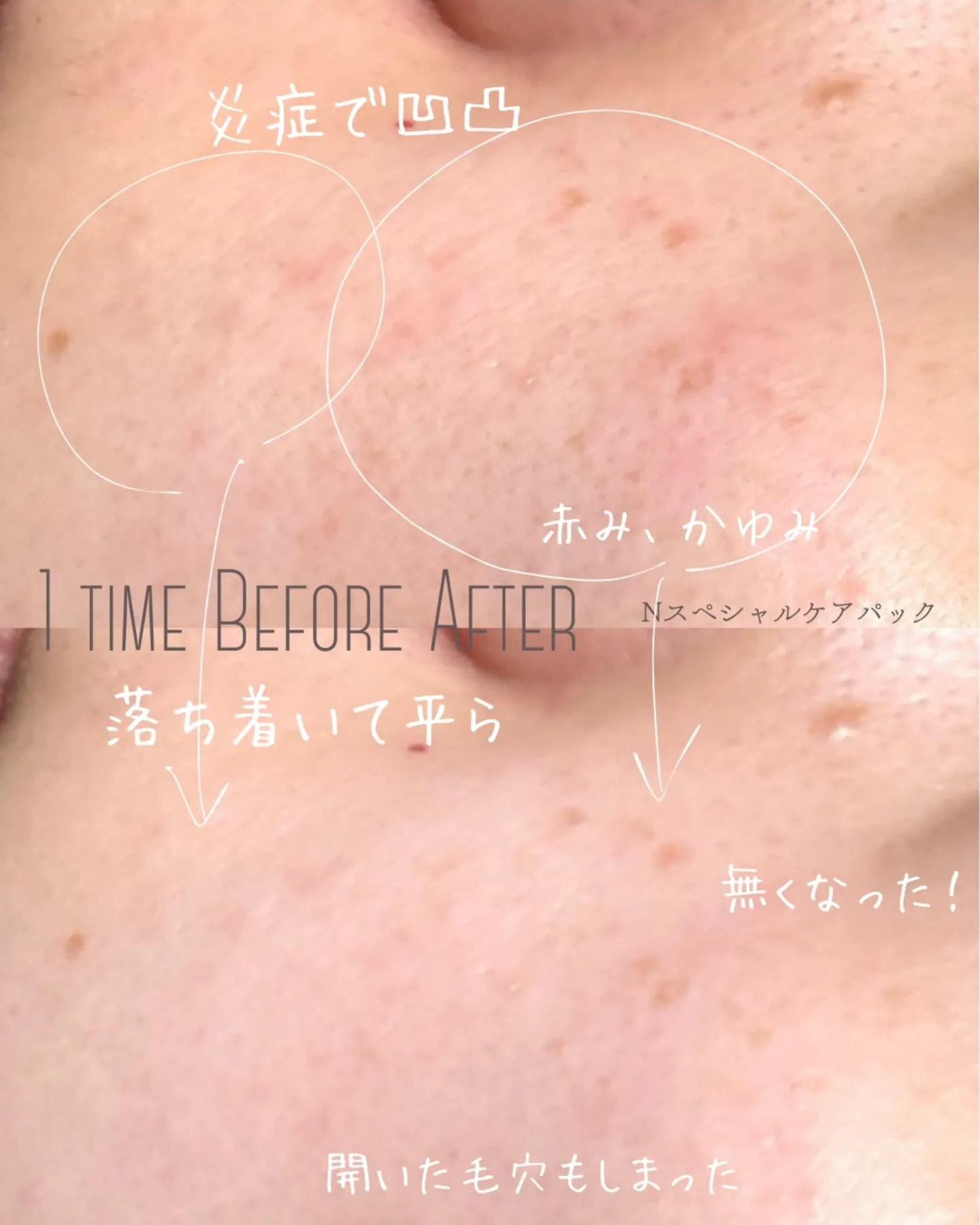 【振るだけじゃない！より鎮静力upのやり方~N~】