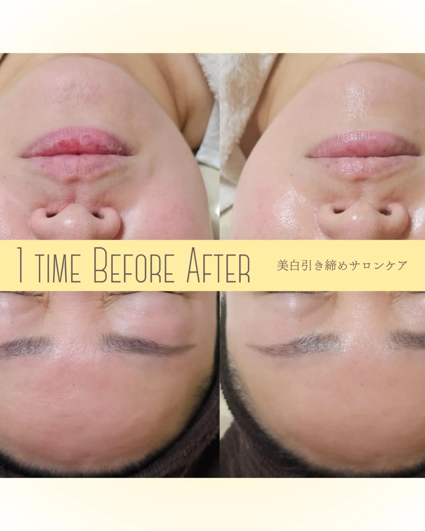 【育てて育てて念願のタラソトリートメント！】