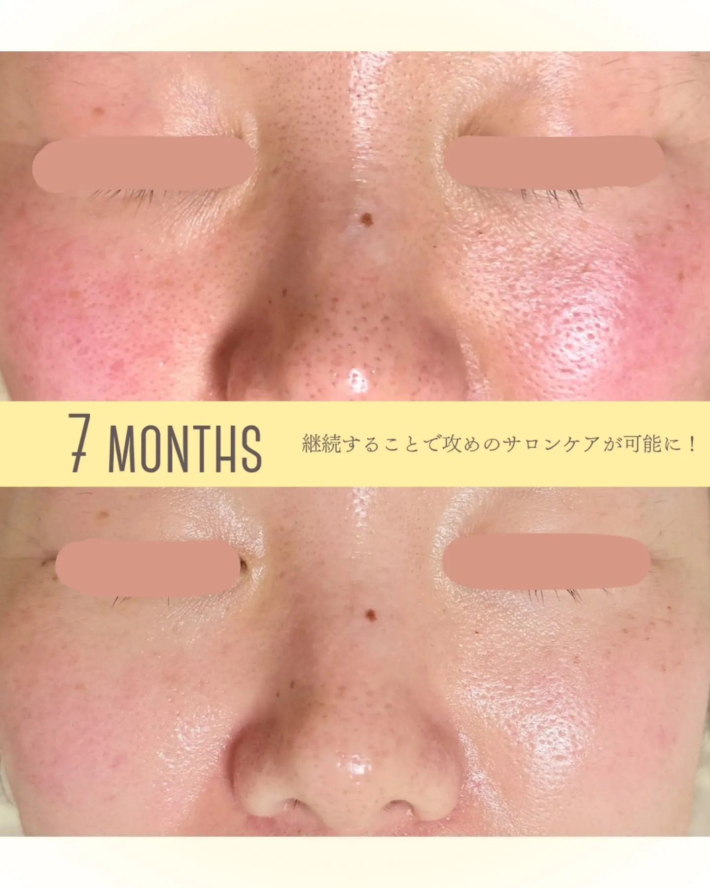 【 鈍感な夫も気付く肌変化✨ 】