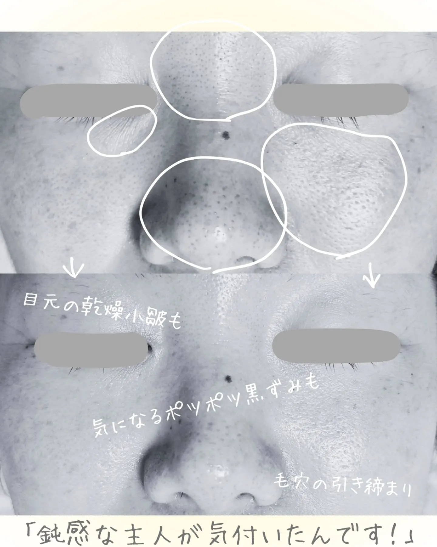 【 鈍感な夫も気付く肌変化✨ 】