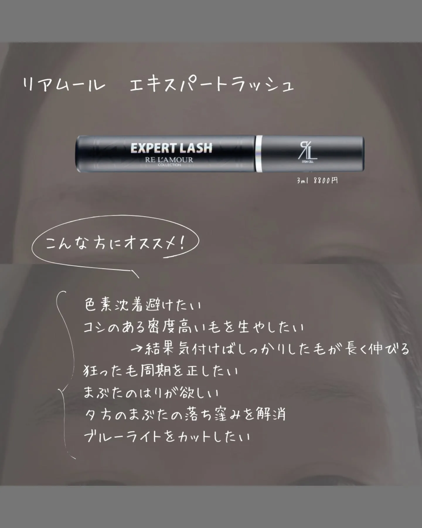 【脱毛症は頭だけじゃないし、でもなんとかなる!】