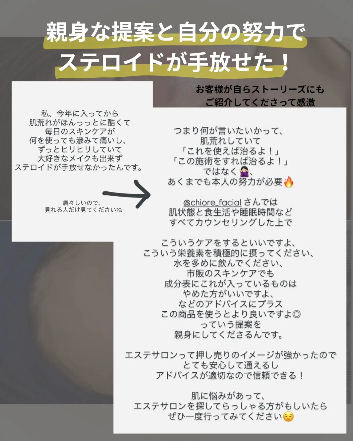 【病院だけじゃない、選択肢】