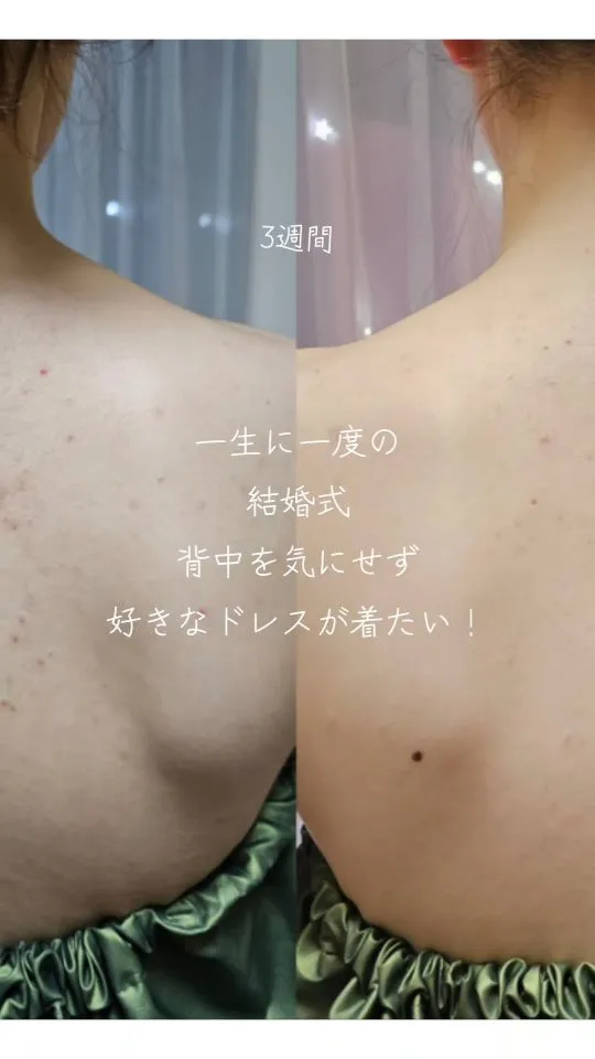 【ドレス、好きなの着よう！！】